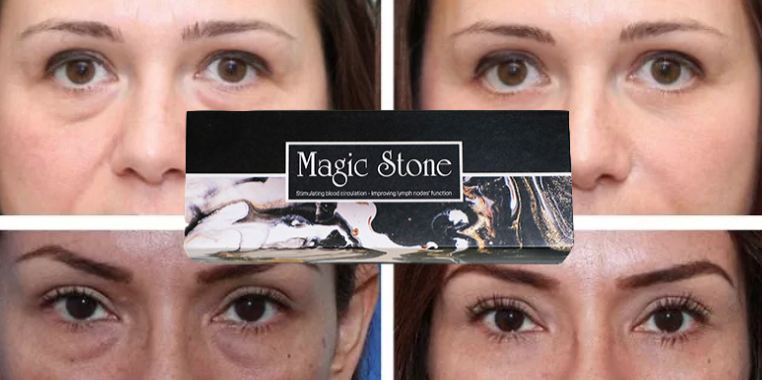 Magic Stone skin care