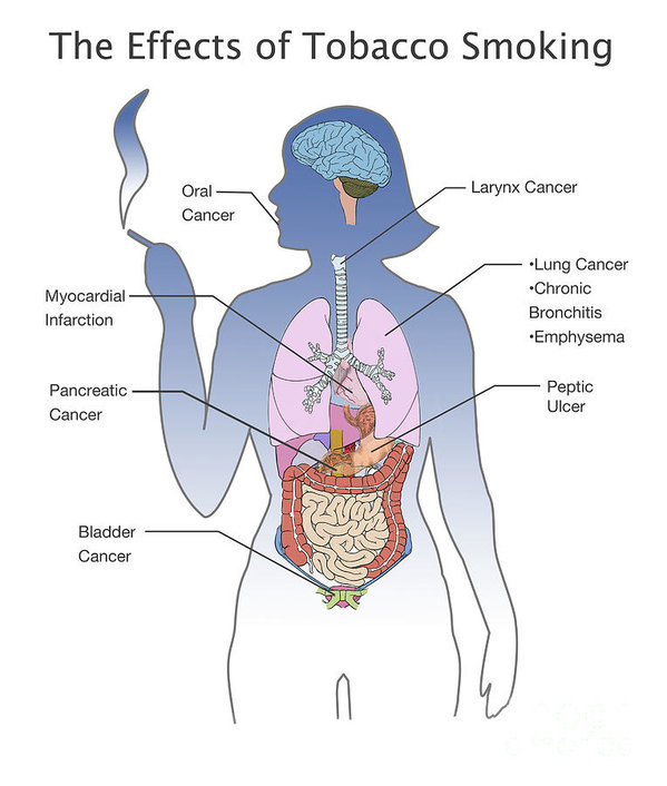 Top 5 Effective Ways Quit Smoking