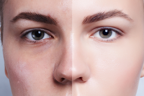 Skin Care