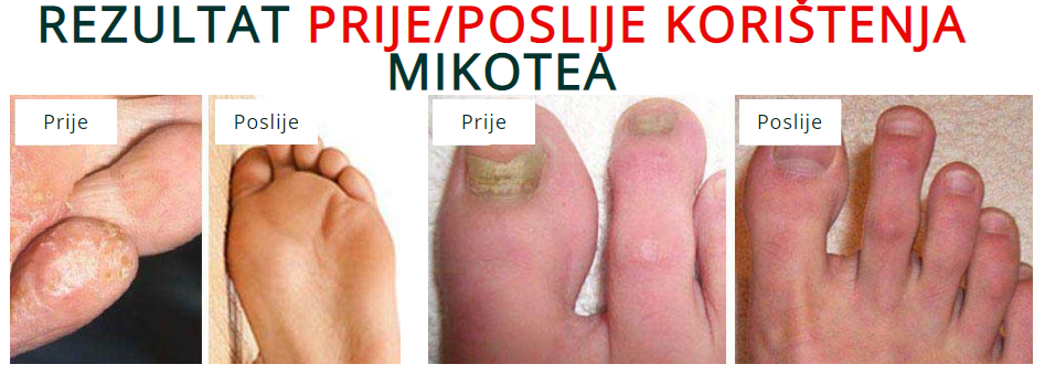 Mikotea Kpristenja