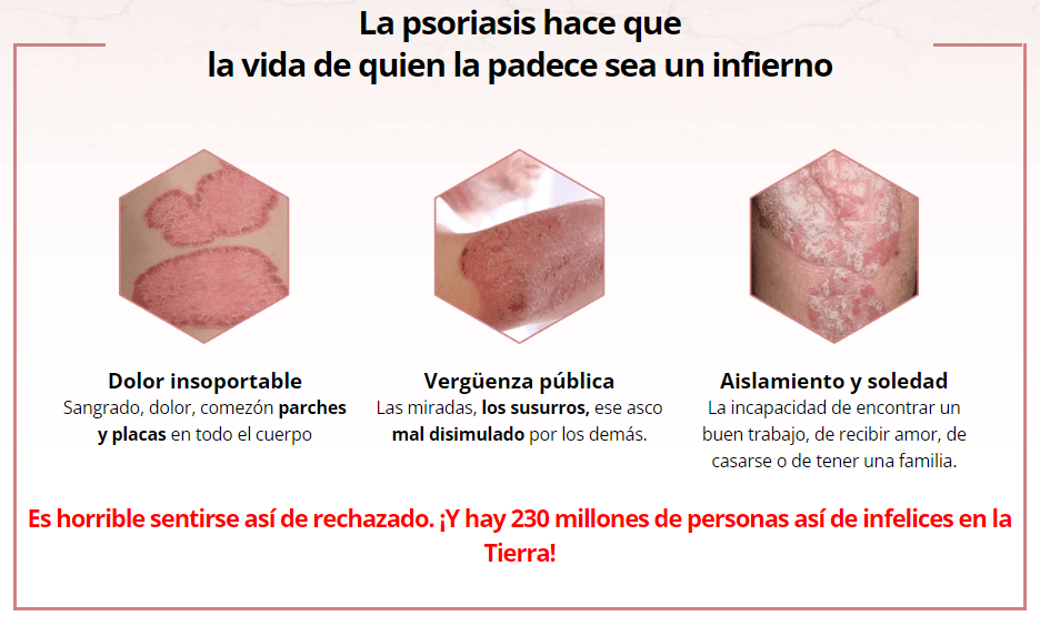 Sorax Psoriasis