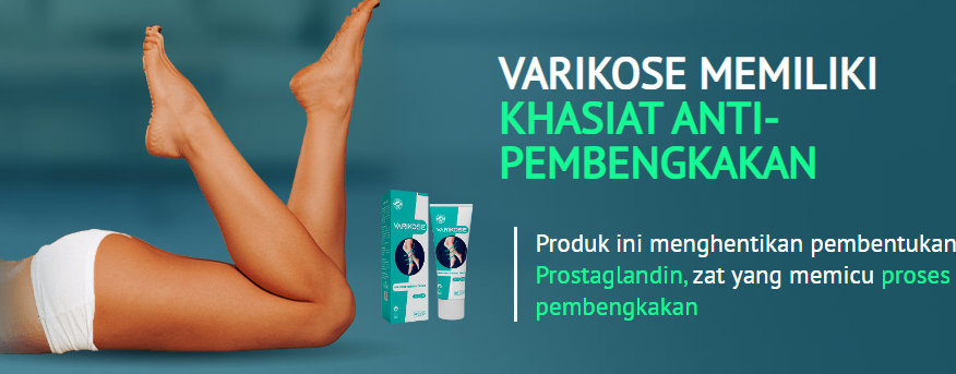 Varikose Pembengkakan