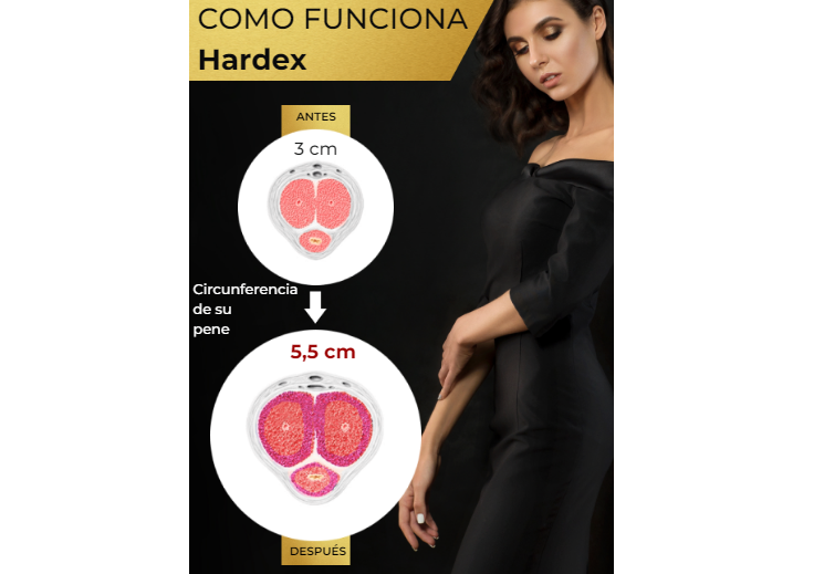 Hardex Funciona