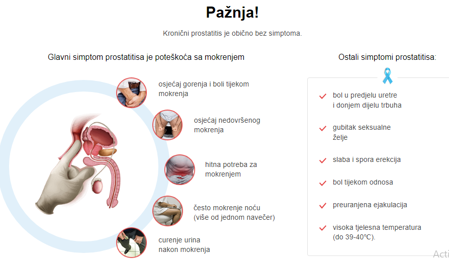 Prostamid Paznja