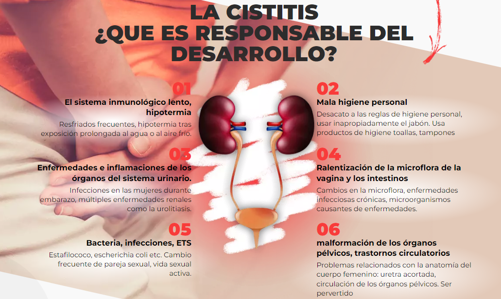 UroFemmin Cistitis