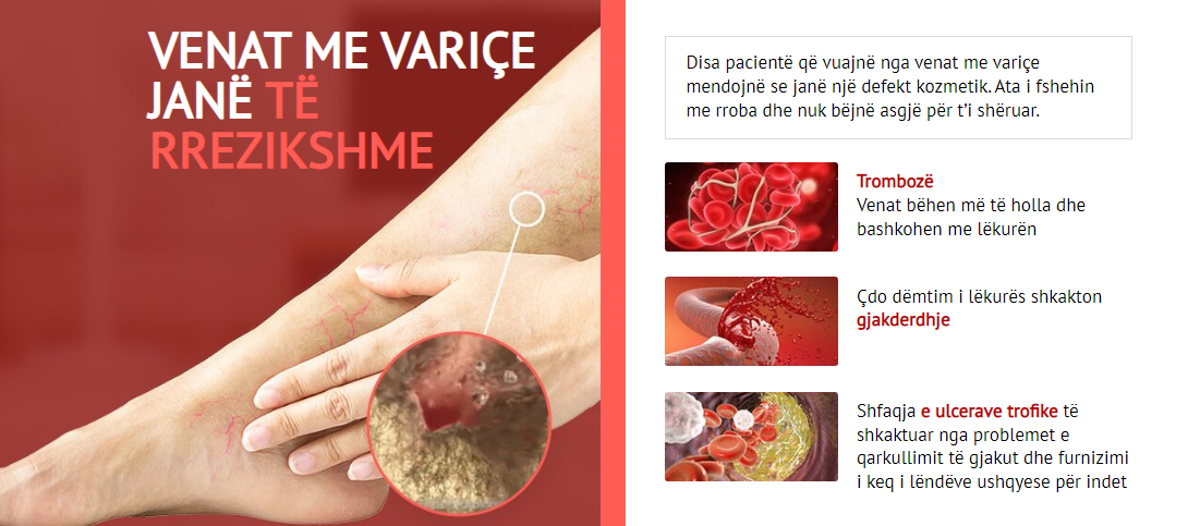 Varcolex Venat