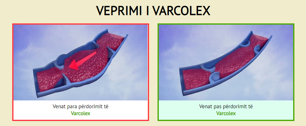 Varcolex Veprimi