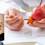 Prostamid | Çaj Një mënyrë natyrale për të promovuar shëndetin e prostatës – Opinionet 2023