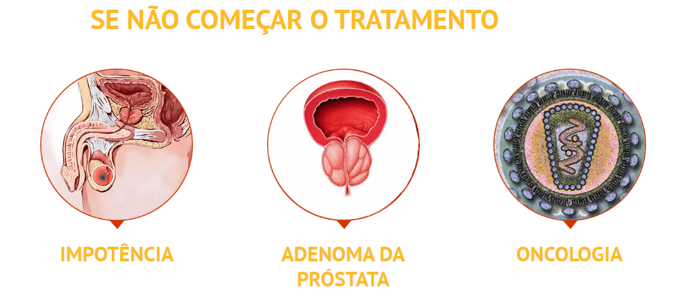 Prostatricum Tratamento