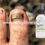 All About Foot Sembur (Spray) Harga 199RM – Semburan Kuku Anti-Kulat (Malaysia)